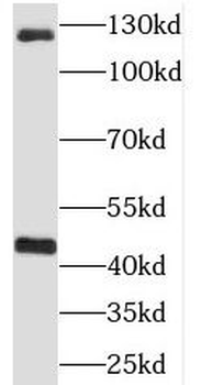 RIMBP2 Antibody