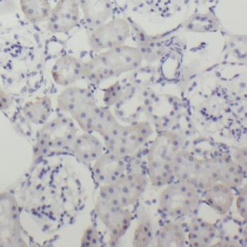 RIMBP2 Antibody