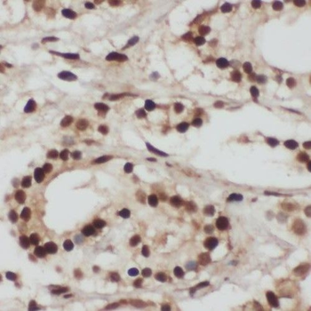 RING1 Antibody
