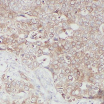 RINT1 Antibody