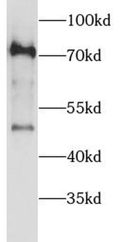 RIOK1 Rabbit Polyclonal Antibody