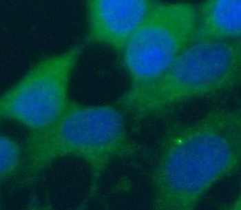 RIOK3 Antibody