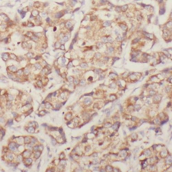 RIOK3 Antibody