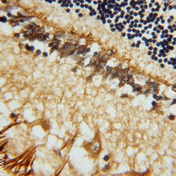 RLBP1 Antibody
