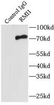 RMI1 Antibody