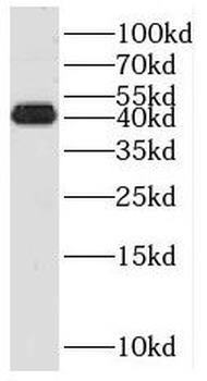 RMND5B Rabbit Polyclonal Antibody