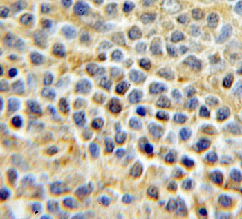 URI1 Antibody