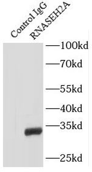 RNASEH2A Antibody