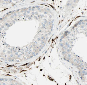 RNASEH2A Antibody