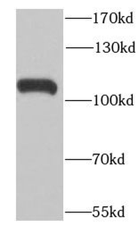 RNASEL Rabbit Polyclonal Antibody