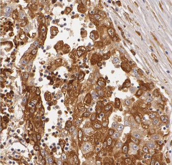 RND3 Antibody