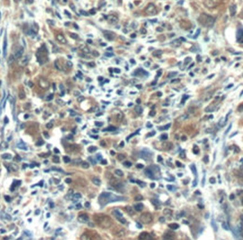 RNF125 Antibody