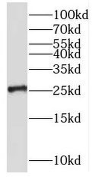 RNF151 Rabbit Polyclonal Antibody