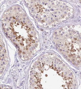 RNF151 Rabbit Polyclonal Antibody