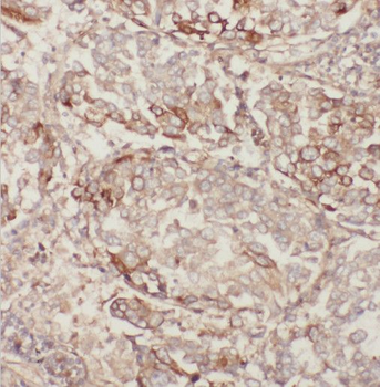 MGRN1 Antibody