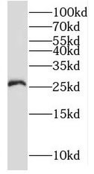 RNF170 Antibody