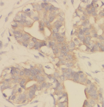 RNF170 Antibody