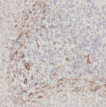 RNF213 Antibody