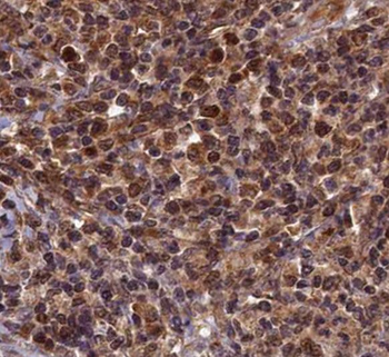 RNF25 Antibody