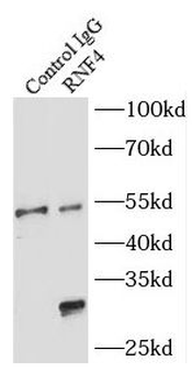 RNF4 Rabbit Polyclonal Antibody