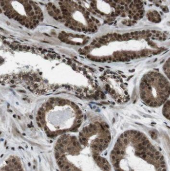 RNF40 Antibody