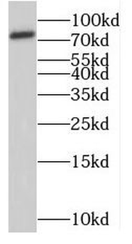 RNF6 Rabbit Polyclonal Antibody