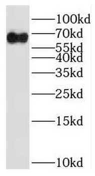 RNPC3 Rabbit Polyclonal Antibody