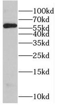 RNPS1 Rabbit Polyclonal Antibody