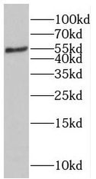 ROBO3 Antibody