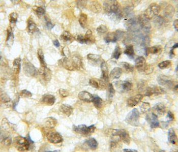 ROBO3 Antibody
