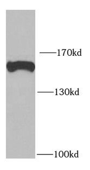 ROCK1 Antibody