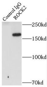 ROCK2 Antibody