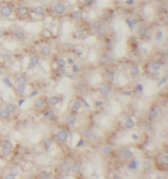 ROCK2 Antibody