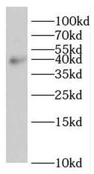 ROM1 Antibody