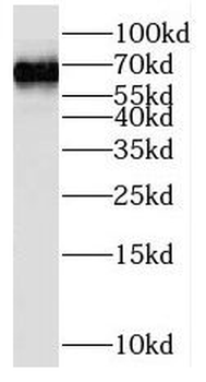 RORA Rabbit Polyclonal Antibody