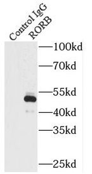 RORB Antibody
