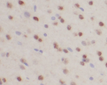 RORB Antibody