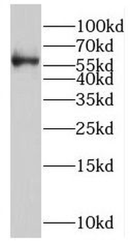 RORC Rabbit Polyclonal Antibody