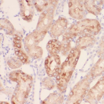 RPGR Antibody