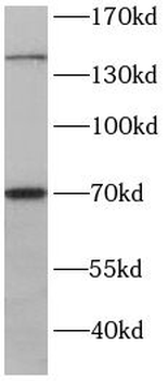 RPGRIP1 Antibody
