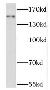 RPGRIP1L Antibody