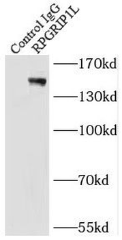 RPGRIP1L Antibody