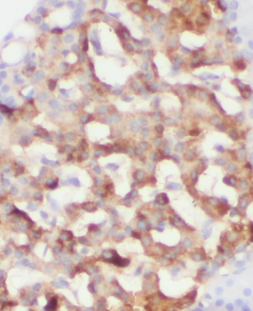 RPGRIP1L Antibody