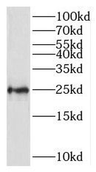RPL10 Rabbit Polyclonal Antibody