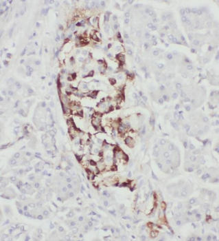 RPL17 Antibody