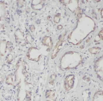RPL18A Antibody