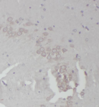 RPL18A Antibody
