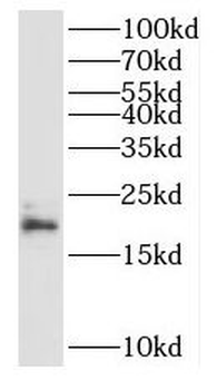 RPL23A Antibody