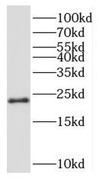RPL24 Antibody