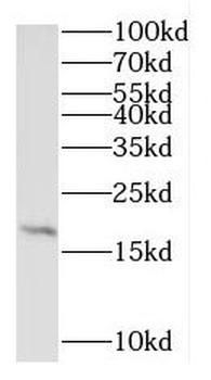 RPL27A Rabbit Polyclonal Antibody